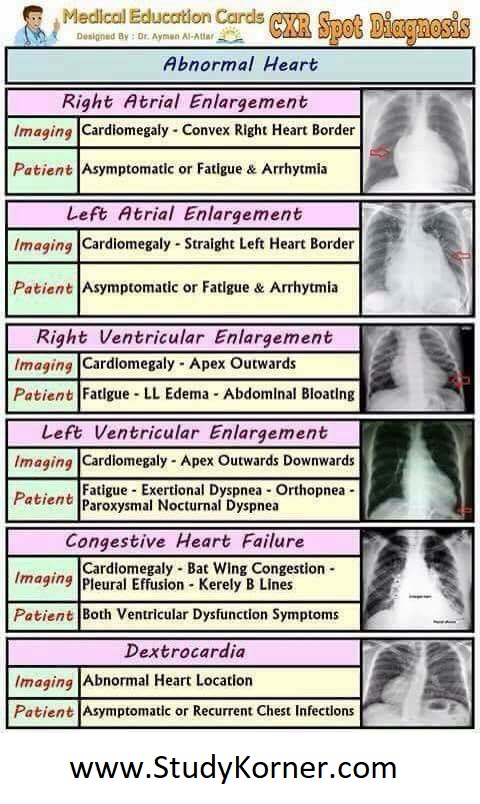 Chest X-Ray Spot Diagnosis Chart: abnormal Heart Radiology Cardiology Emergency Nursing
