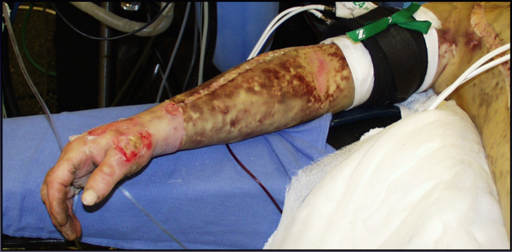 NCLEX-RN Exam Practice Questions: Quiz 2 - NCLEX Quiz