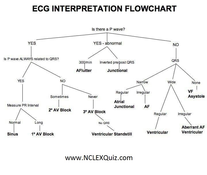 ECG Interpretation Flowchart