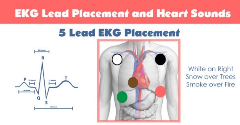 5 Lead EKG Placementjpg_Page1 - Copy - NCLEX Quiz