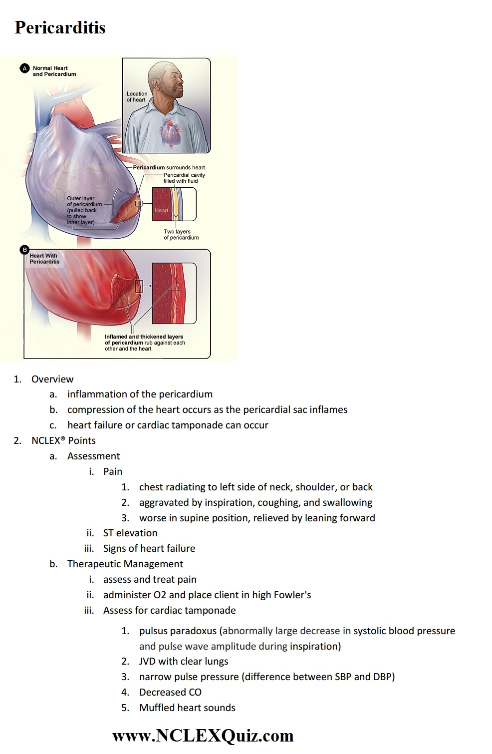 NCLEX Cardiac Points: Pericarditis