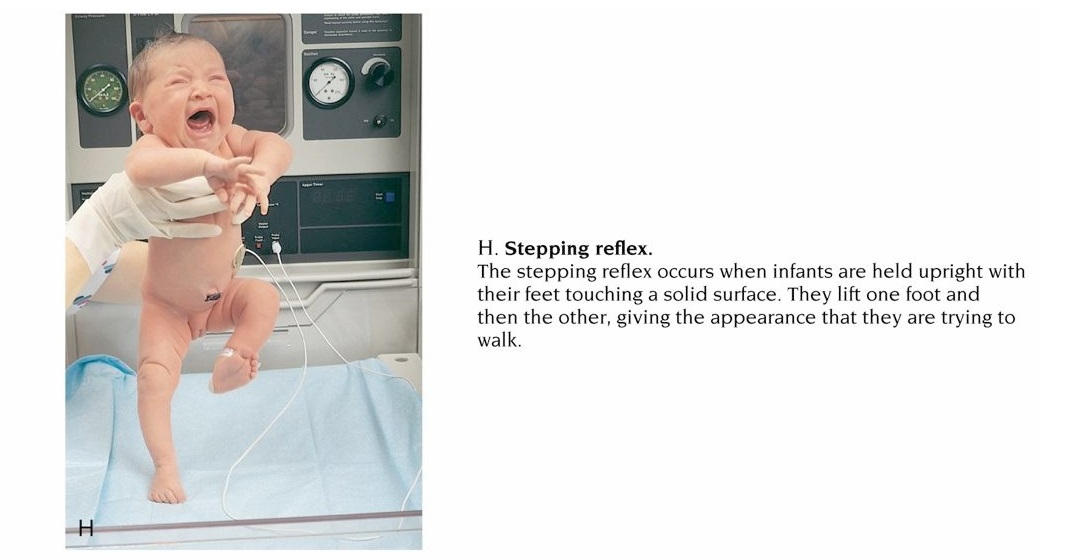 Types of Newborn Reflexes NCLEX Quiz