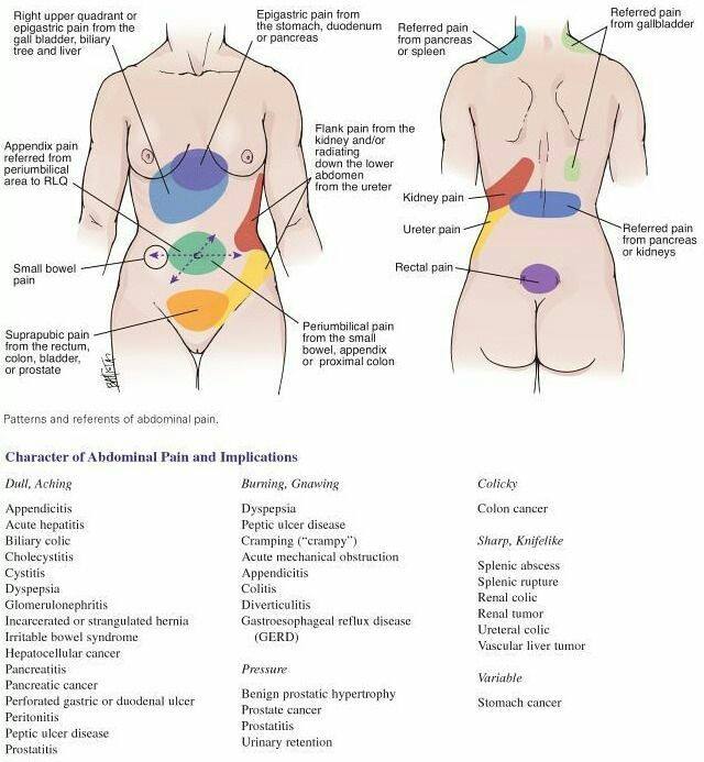 Abdominal pain Differential Diagnosis Chart