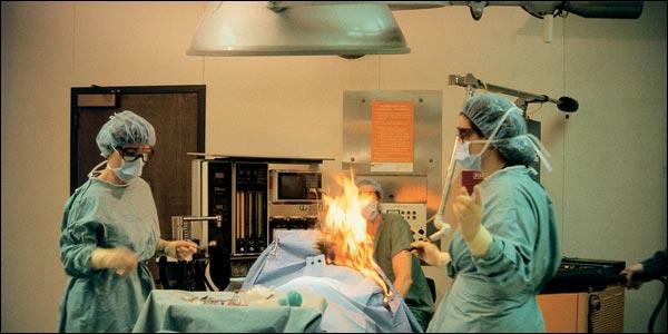 Patient's fart sparks fire that burns her during surgery