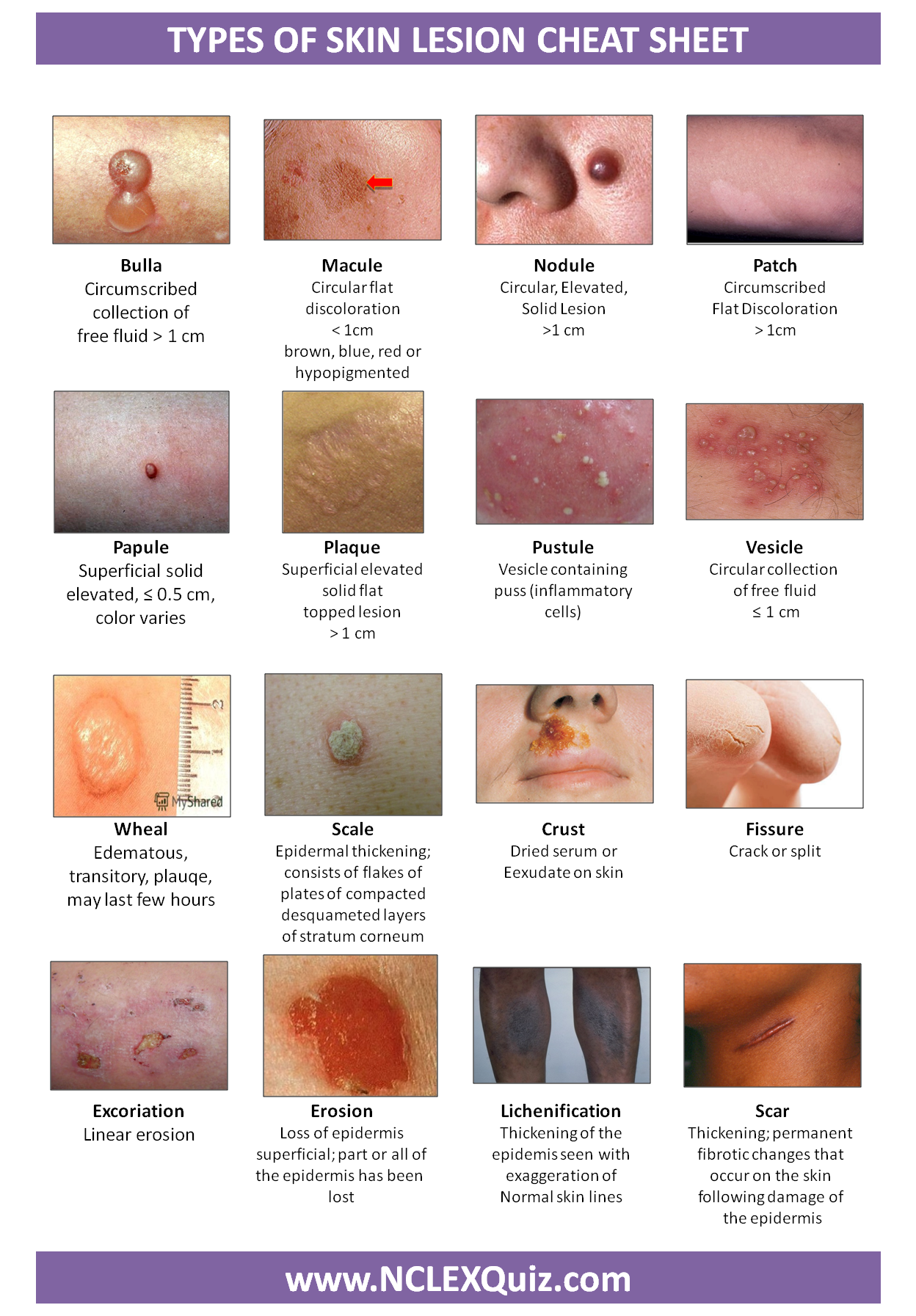Types Of Skin Lesions Chart