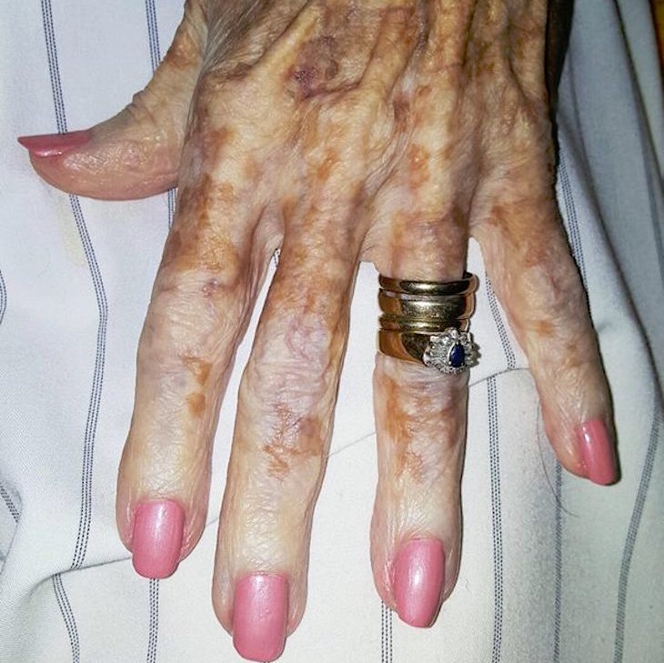 Woman Works In Nursing Home, Snaps Picture Of Resident's Hand That's Going Viral
