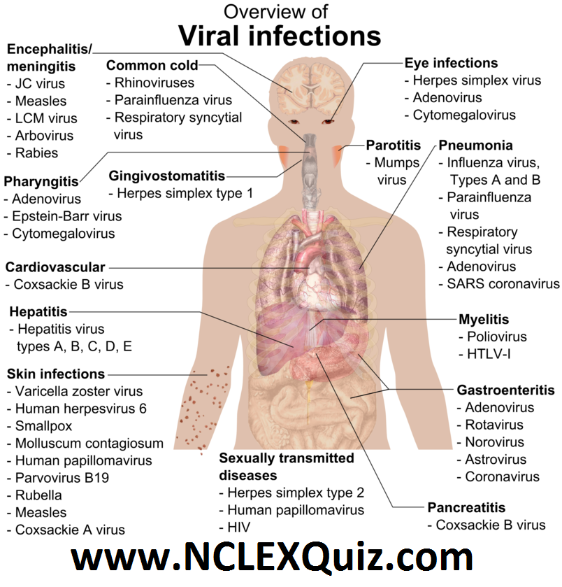 Overview of the Ciral Infections Chart