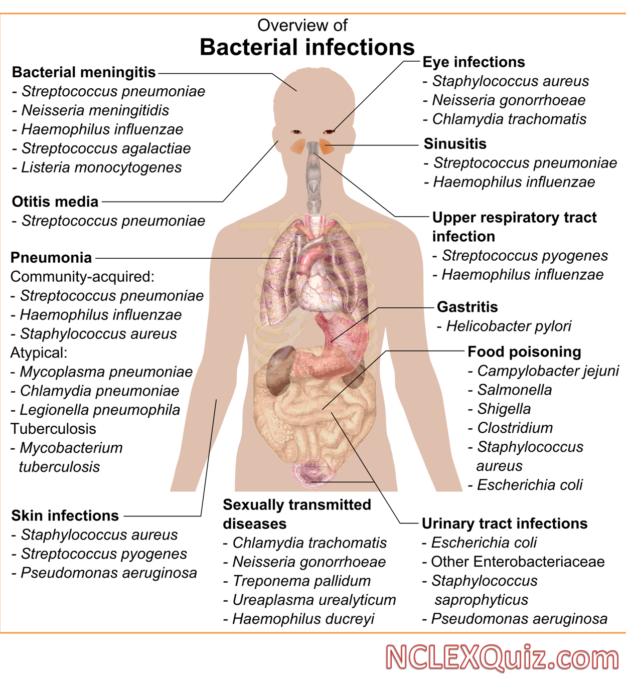 Overview of the Bacterial Infections Chart