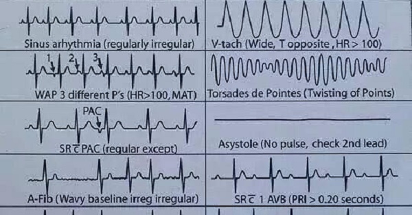 9. EKG Heart Rate Nail Art - wide 9