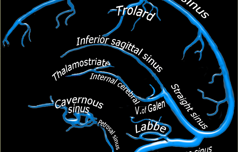 Anatomy of cerebral veins and sinuses