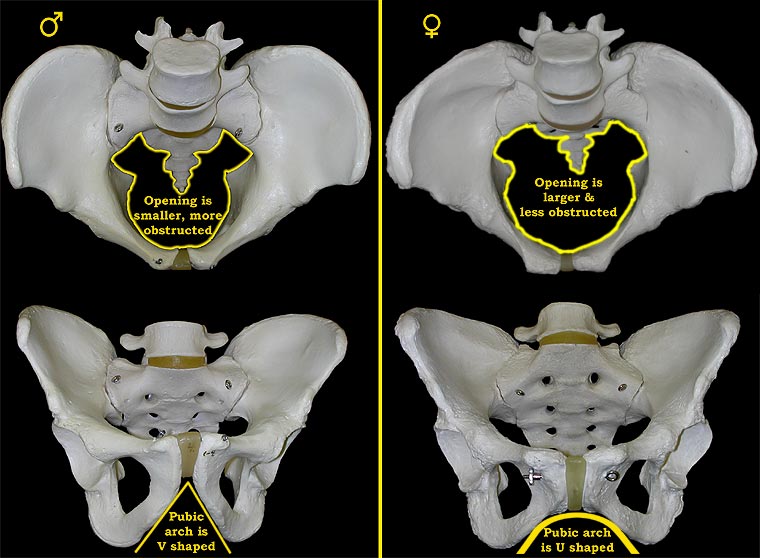 Male versus Female Pelvis – Labeled Radiographic Anatomy