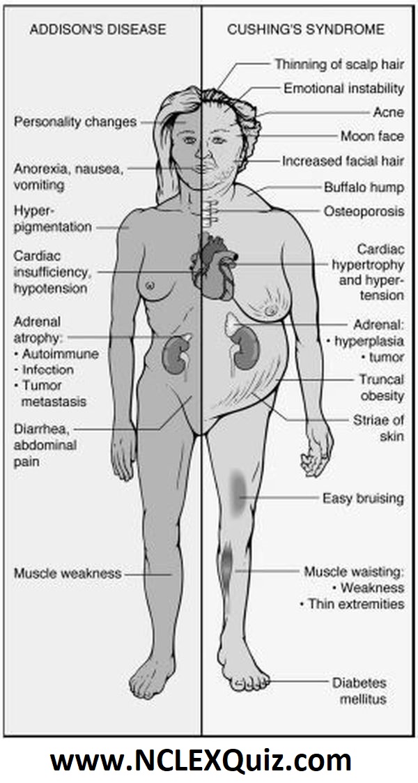 Addison's Disease vs Cushing's Syndrome