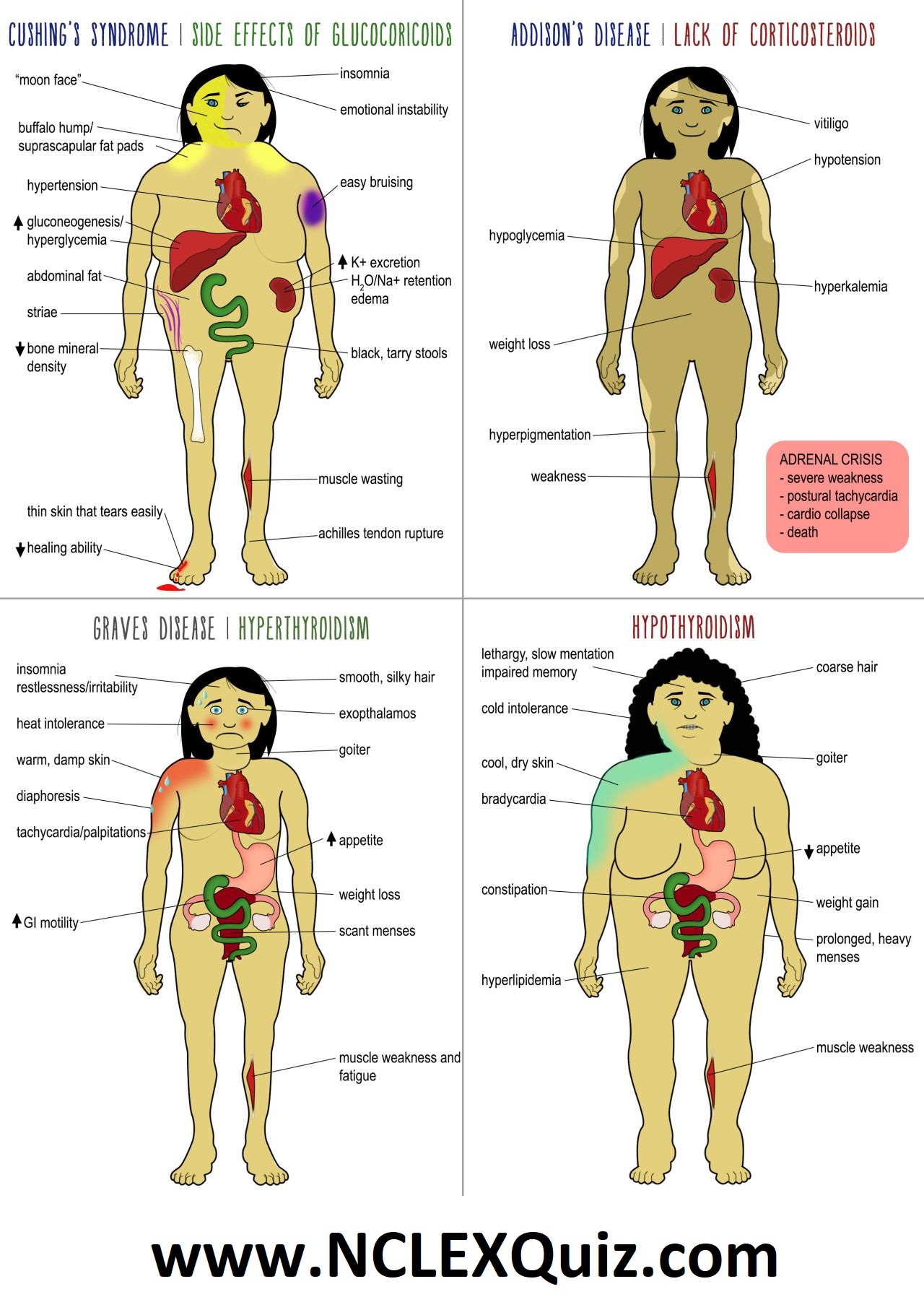 Endocrine Disorders Hypothyroidism and Addison's disease