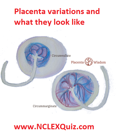 Placenta variations: Circummarginate and Circumvallate