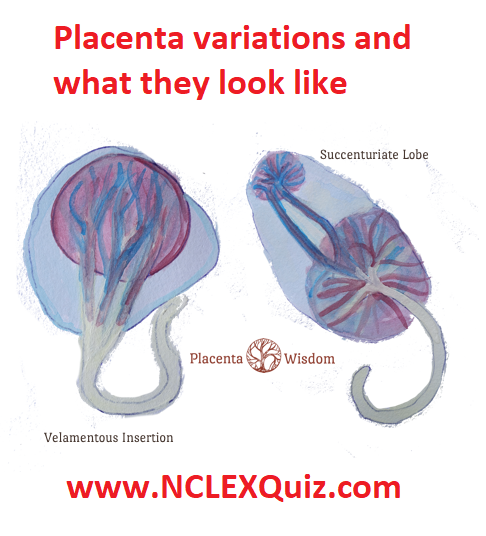 Placenta variations: Succenturiate Lobe and Velamentous