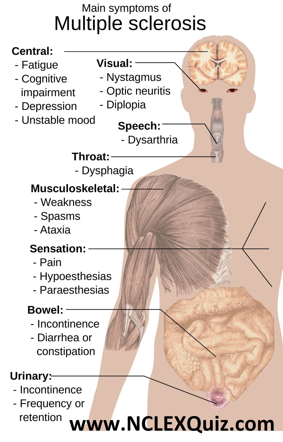 Multiple Sclerosis Nursing: Signs and Symptoms