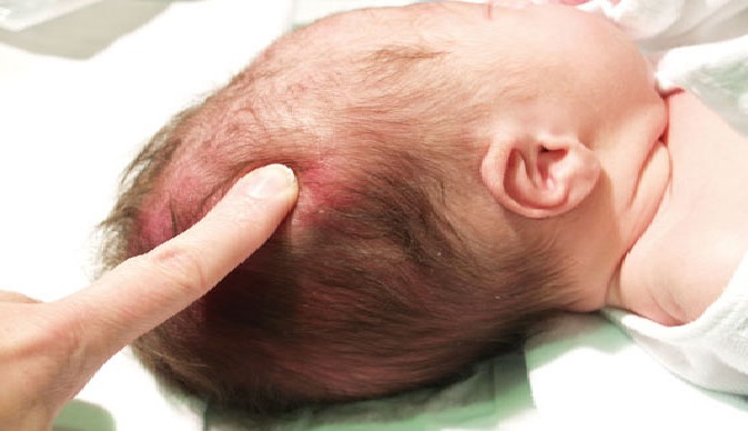 Prioritizing Care for a Newborn with an Apgar Score of 8: NCLEX Practice Quiz