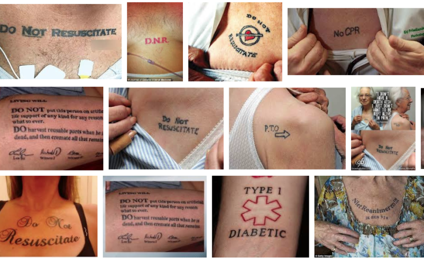 Do Not Resuscitate Order and Advanced Directives